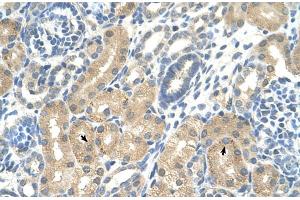 Rabbit Anti-KHK Antibody  Paraffin Embedded Tissue: Human Kidney Cellular Data: Epithelial cells of renal tubule Antibody Concentration: 4. (Ketohexokinase anticorps  (C-Term))