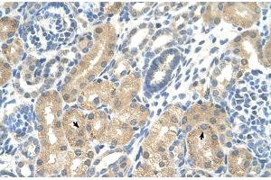 Rabbit Anti-KHK Antibody  Paraffin Embedded Tissue: Human Kidney Cellular Data: Epithelial cells of renal tubule Antibody Concentration: 4.