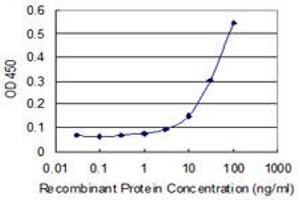 Detection limit for recombinant GST tagged RSPH1 is 3 ng/ml as a capture antibody.