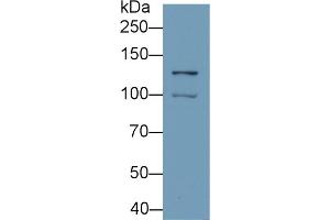 Detection of HIF1a in Hela cell lysate using Monoclonal Antibody to Hypoxia Inducible Factor 1 Alpha (HIF1a)