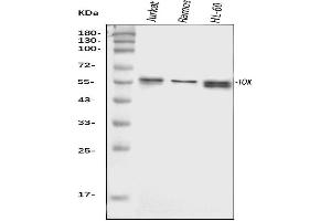 Western blot analysis of TOX using anti-TOX antibody (ABIN7599443).