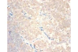 Immunohistochemistry of paraffin-embedded human lymph node tissue using ABIN7145987 at dilution of 1:100 (CCL24 anticorps  (AA 27-119))