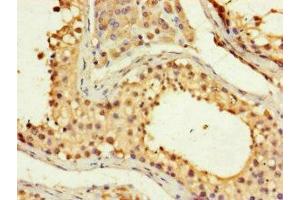 Immunohistochemistry of paraffin-embedded human testis tissue using ABIN7153118 at dilution of 1:100 (Formin-Like 3 anticorps  (AA 2-212))