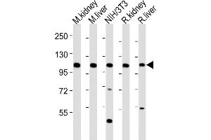 All lanes : Anti-Mertk Antibody (C-term) at 1:2000 dilution Lane 1: mouse kidney lysates Lane 2: mouse liver lysates Lane 3: NIH/3T3 whole cell lysates Lane 4: rat kidney lysates Lane 5: rat liver lysates Lysates/proteins at 20 μg per lane. (MERTK anticorps  (C-Term))