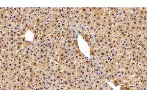 Detection of GSTa3 in Rat Liver Tissue using Polyclonal Antibody to Glutathione S Transferase Alpha 3 (GSTa3) (GSTA3 anticorps  (AA 1-222))