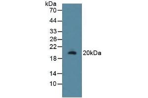 Detection of RSPO1 in Rat Uterus Tissue using Polyclonal Antibody to R-Spondin 1 (RSPO1)