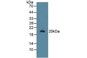 Detection of RSPO1 in Rat Uterus Tissue using Polyclonal Antibody to R-Spondin 1 (RSPO1) (RSPO1 anticorps  (AA 136-262))