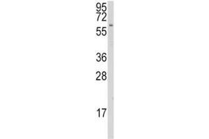Western blot analysis of CYP1A1 antibody and K562 lysate.