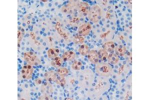 Used in DAB staining on fromalin fixed paraffin- embedded kidney tissue