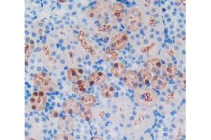 Used in DAB staining on fromalin fixed paraffin- embedded kidney tissue (GSTA1 anticorps  (AA 2-222))