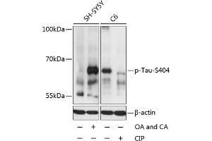 Western blot analysis of extracts of SH-SY5Y and C6 cells, using Phospho-Tau-S404 antibody (ABIN3019703, ABIN3019704, ABIN3019705 and ABIN1681813) at 1:2000 dilution. (MAPT anticorps  (pSer404))
