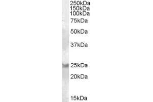 Image no. 1 for anti-RAB8A, Member RAS Oncogene Family (RAB8A) (C-Term) antibody (ABIN374945) (RAB8A anticorps  (C-Term))