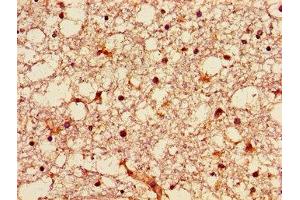 Immunohistochemistry of paraffin-embedded human brain tissue using ABIN7149942 at dilution of 1:100 (GNPAT anticorps  (AA 589-680))