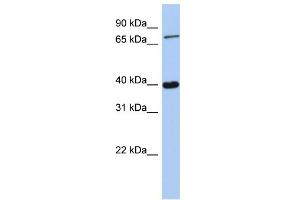 WB Suggested Anti-PRDM4 Antibody Titration:  0. (PRDM4 anticorps  (C-Term))