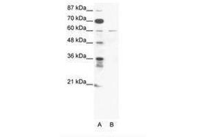 Image no. 1 for anti-Zinc Finger Protein 92 (ZNF92) (C-Term) antibody (ABIN203188) (ZNF92 anticorps  (C-Term))