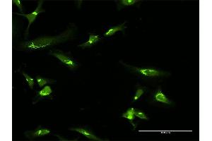 Immunofluorescence of purified MaxPab antibody to GOLGA2 on HeLa cell. (Golgin A2 (GOLGA2) (AA 1-990) anticorps)