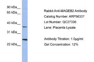 WB Suggested Anti-MAGEB2  Antibody Titration: 0. (MAGEB2 anticorps  (N-Term))