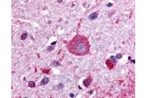 Immunohistochemistry (IHC) image for anti-G Protein-Coupled Receptor, Family C, Group 5, Member B (GPRC5B) (C-Term) antibody (ABIN2469384)