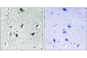 Immunohistochemistry analysis of paraffin-embedded human brain, using JAK2 (Phospho-Tyr931) Antibody. (JAK2 anticorps  (pTyr931))
