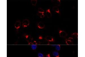 Confocal immunofluorescence analysis of Hela cells using USO1 Polyclonal Antibody at dilution of 1:200. (USO1 anticorps)