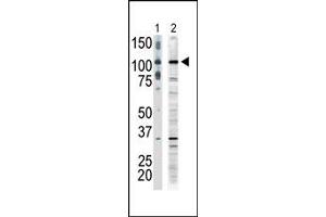 anti-Mitogen-Activated Protein Kinase Kinase Kinase 9 (MAP3K9) (C-Term) antibody