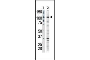 Image no. 1 for anti-Mitogen-Activated Protein Kinase Kinase Kinase 9 (MAP3K9) (C-Term) antibody (ABIN360307) (MAP3K9 anticorps  (C-Term))