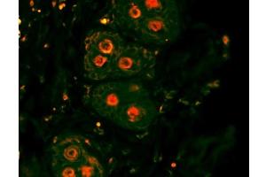 Formalin-fixed and paraffin-embedded rat skin labeled with Anti-β-catenin/Catenin β Polyclonal Antibody, Unconjugated 1:200, overnight at 4°C, The secondary antibody was Goat Anti-Rabbit IgG, PE conjugated-PE)used at 1:200 dilution for 40 minutes at 37°C.