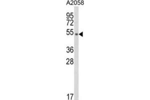 Western Blotting (WB) image for anti-Disabled Homolog 2, Mitogen-Responsive phosphoprotein (Drosophila) (DAB2) antibody (ABIN3003993) (DAB2 anticorps)