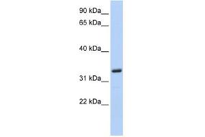 WB Suggested Anti-MS4A4A Antibody Titration: 0. (MS4A4A anticorps  (N-Term))