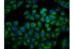 Immunofluorescence staining of Hela cells with ABIN7143334 at 1:133, counter-stained with DAPI. (ADCY6 anticorps  (AA 9-118))