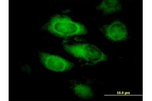 Immunofluorescence of purified MaxPab antibody to ANXA9 on HeLa cell.