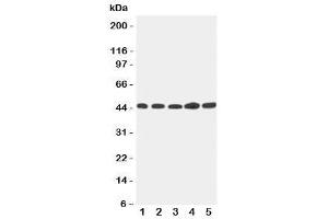 Western blot testing of Hepsin antibody and Lane 1:  293T