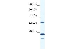 WB Suggested Anti-ZNF688 Antibody Titration:  2. (ZNF688 anticorps  (Middle Region))