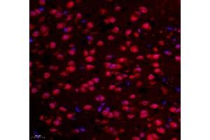 Immunofluorescence of paraffin embedded mouse prefrontal lobe using NCBP2 (ABIN7074870) at dilution of 1: 650 (400x lens)