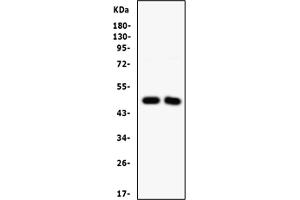 Western blot analysis of SFRP4 using anti-SFRP4 antibody (ABIN3044543).