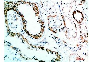 Immunohistochemical analysis of paraffin-embedded human-testis, antibody was diluted at 1:200 (IL-31 anticorps  (AA 21-70))