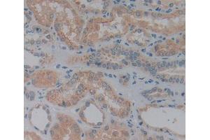 Used in DAB staining on fromalin fixed paraffin- embedded Kidney tissue