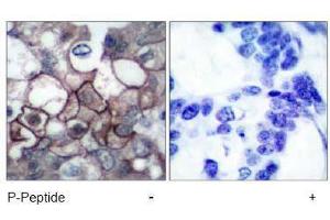 Image no. 2 for anti-Epidermal Growth Factor Receptor (EGFR) (pTyr1197) antibody (ABIN196974) (EGFR anticorps  (pTyr1197))