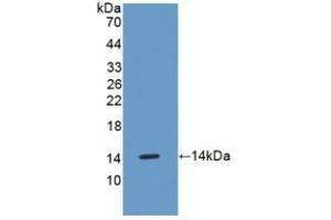Detection of Recombinant OSM, Mouse using Polyclonal Antibody to Oncostatin M (OSM)