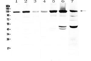 Western blot analysis of Eph receptor A2  using anti-Eph receptor A2  antibody . (EPH Receptor A2 anticorps  (AA 851-970))