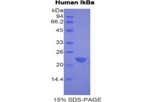 SDS-PAGE analysis of Human IkBa Protein. (Inhibitory Subunit Of NF kappa B alpha Protéine)
