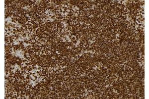 ABIN6262736 and ABIN6277134 at 1/100 staining Mouse spleen tissue by IHC-P. (KBTBD3 anticorps  (C-Term))