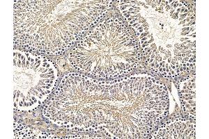 ABIN7096253 and ABIN7100315 at 1/100 staining rat testis tissue by IHC-P.