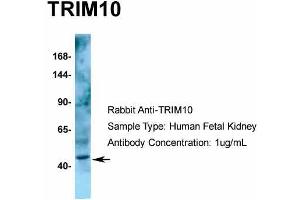 Host: Rabbit  Target Name: TRIM10  Sample Tissue: Human Fetal Kidney  Antibody Dilution: 1. (TRIM10 anticorps  (C-Term))