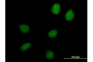 Immunofluorescence of purified MaxPab antibody to C17orf66 on HeLa cell. (C17orf66 anticorps  (AA 1-219))