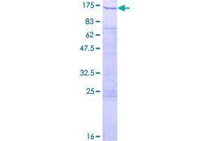 Image no. 1 for SWI/SNF Related, Matrix Associated, Actin Dependent Regulator of Chromatin, Subfamily A-Like 1 (SMARCAL1) (AA 1-954) protein (GST tag) (ABIN1320629)