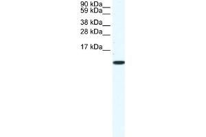 WB Suggested Anti-CCL5 Antibody Titration:  1. (CCL5 anticorps  (Middle Region))