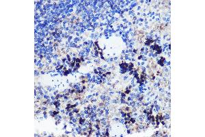 Immunohistochemistry of paraffin-embedded Rat spleen using FCHSD1 Rabbit pAb (ABIN7270317) at dilution of 1:100 (40x lens). (FCHSD1 anticorps  (AA 100-400))