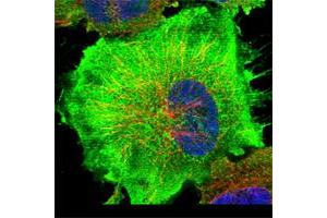 Immunofluorescent staining of human cell line U-251 MG shows positivity in plasma membrane & cytoplasm. (C9 anticorps)