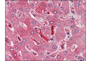 Human Liver (formalin-fixed, paraffin-embedded) stained with FTH1at 4 µg/ml followed by biotinylated anti-goat IgG secondary antibody, alkaline phosphatase-streptavidin and chromogen. (FTH1 anticorps  (C-Term, Heavy Chain))
